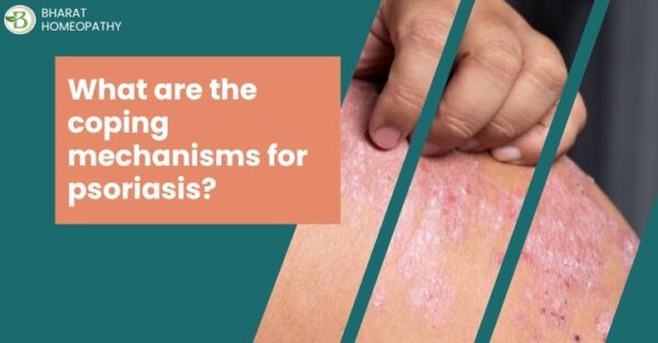 Causes, Triggers, and Treatment Options for Psoriasis