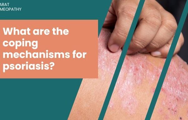 Causes, Triggers, and Treatment Options for Psoriasis