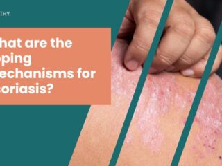 What-are-the-coping-mechanisms-for-psoriasis